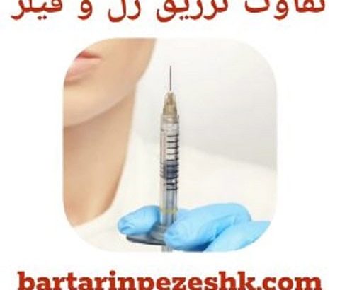 تفاوت تزریق ژل و فیلر