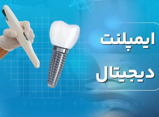 دندانپزشکی تخصصی ایمپلنت دیجیتال