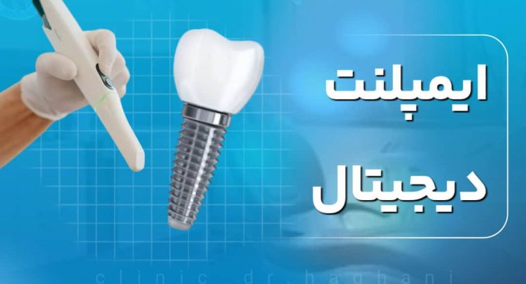 دندانپزشکی تخصصی ایمپلنت دیجیتال